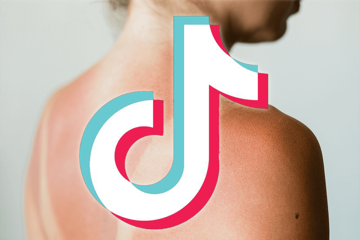 'That's cooked': TikTok's answer to dangerous 'sunburn challenge' trend