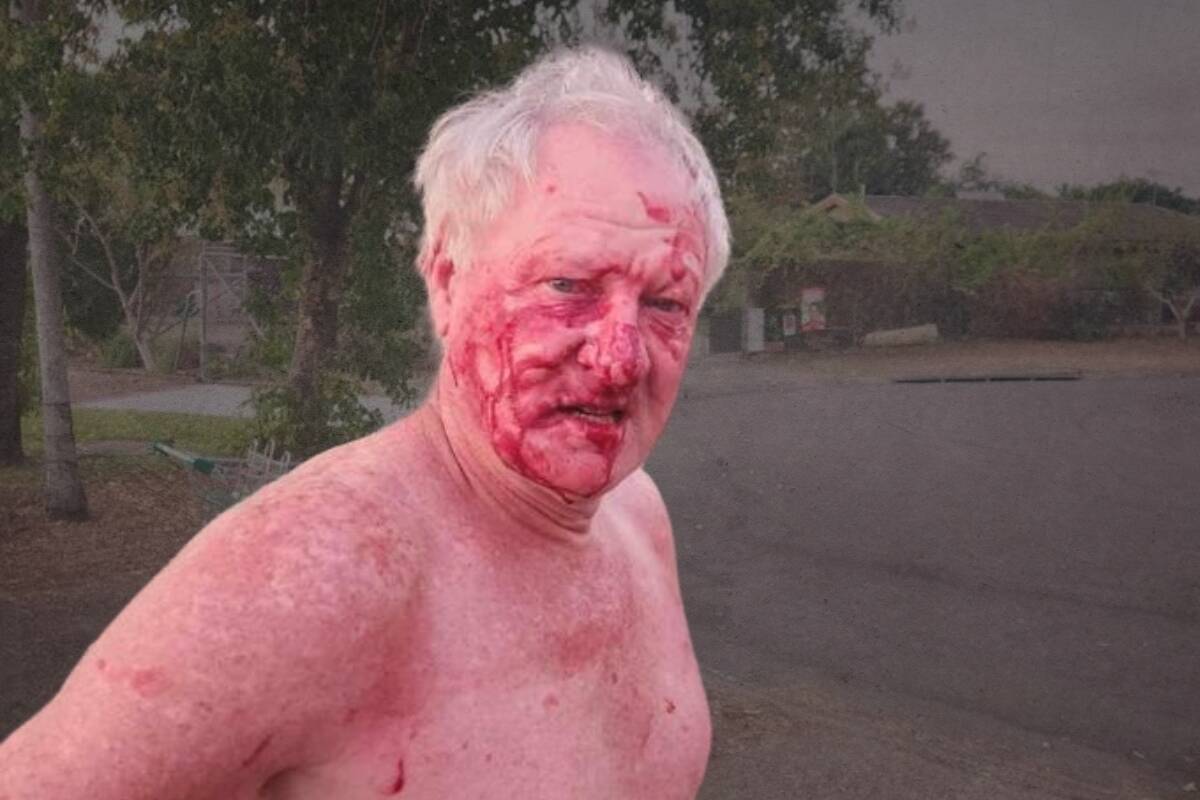 Article image for ‘Face of fear’ – Man bashed by gang of girls