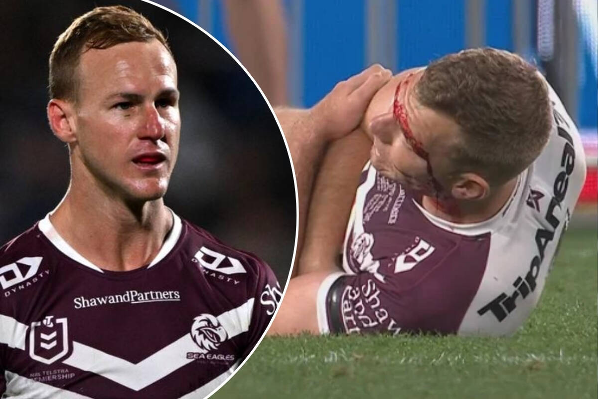 Article image for ‘Bloody tough’: Why DCE is backing Turbo to return from latest injury