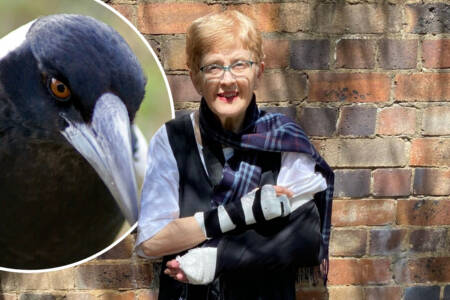 Exclusive – Woman suffers 2 broken arms after magpie attack